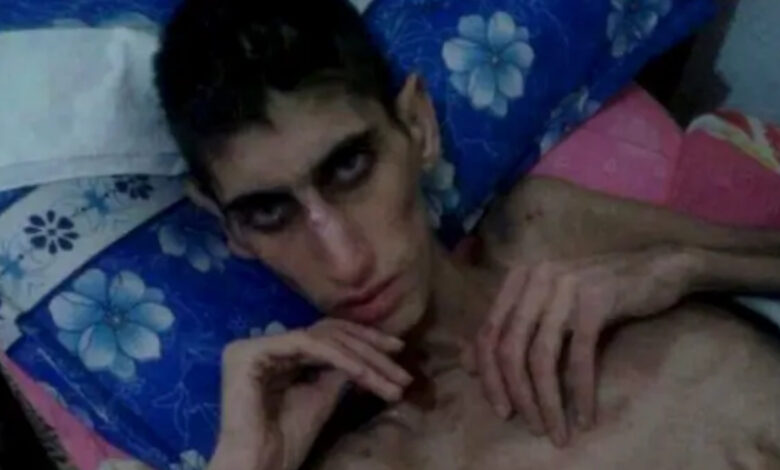 Madaya: Hizbullah’ın insanları aç bırakarak öldürdüğü Suriye kasabası