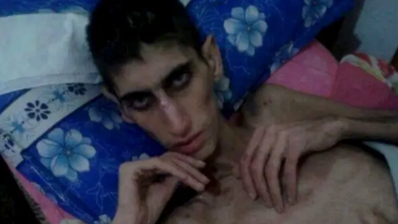 Madaya: Hizbullah’ın insanları aç bırakarak öldürdüğü Suriye kasabası Madaya: Hizbullah’ın insanları aç bırakarak öldürdüğü Suriye kasabası