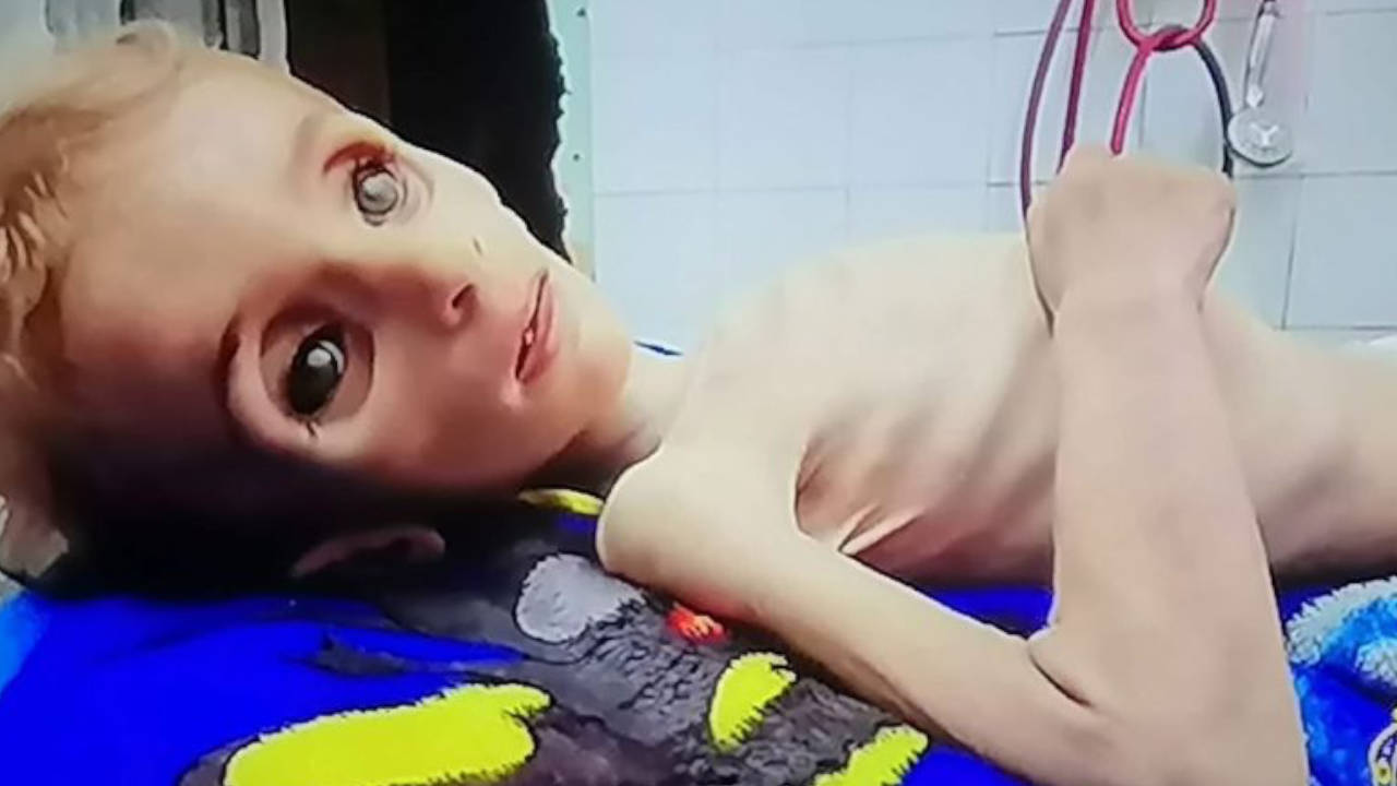 Gazze’de bir çocuk daha açlıktan can verdi Gazze’de bir çocuk daha açlıktan can verdi