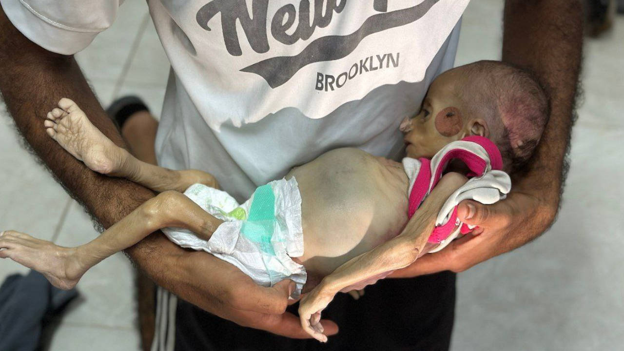 Gazze’de 100 binden fazla çocuk İsrail ablukası nedeniyle ölüm riski altında Gazze’de 100 binden fazla çocuk İsrail ablukası nedeniyle ölüm riski altında
