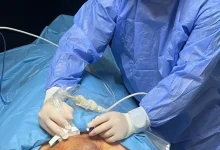 SAĞLIKDevasa büyüklükteki guatr ameliyatsız tedavi edildi