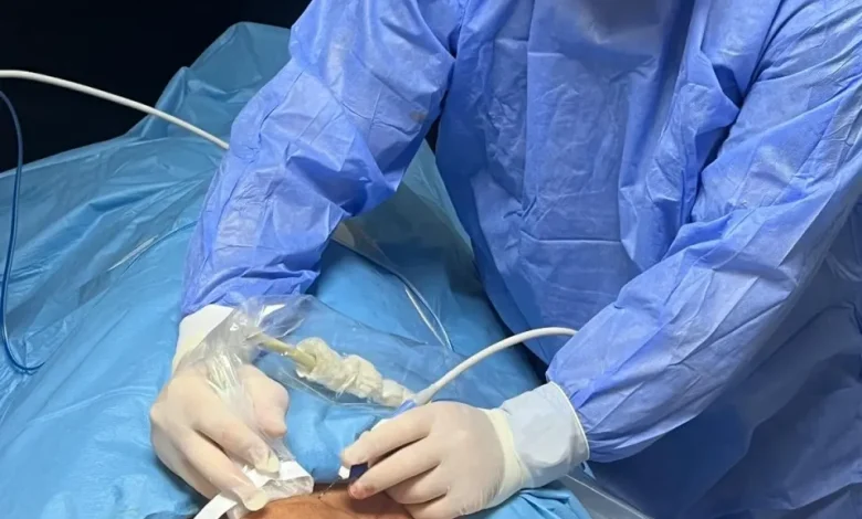 SAĞLIKDevasa büyüklükteki guatr ameliyatsız tedavi edildi
